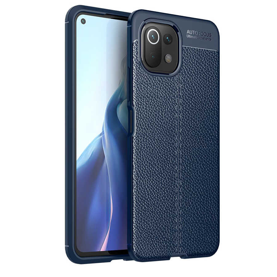Xiaomi Uyumlu  Mi 11 Lite Kılıf Zore Niss Silikon Kapak-Lacivert