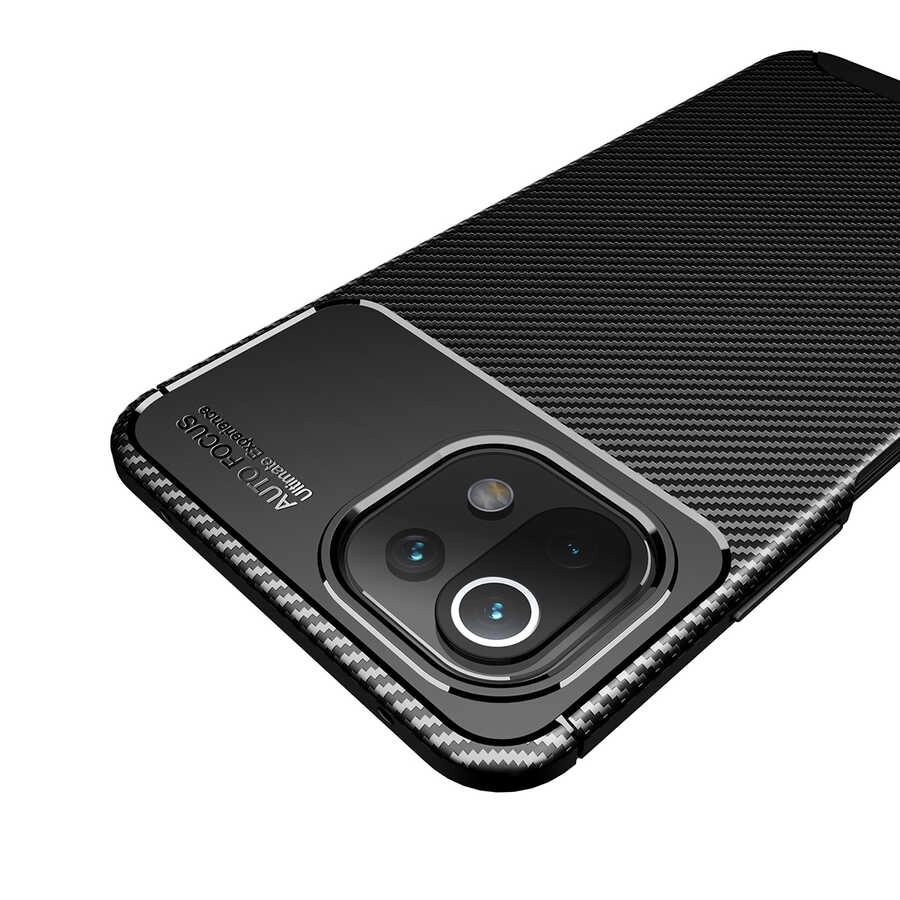 Xiaomi Uyumlu  Mi 11 Lite Kılıf Zore Negro Silikon Kapak