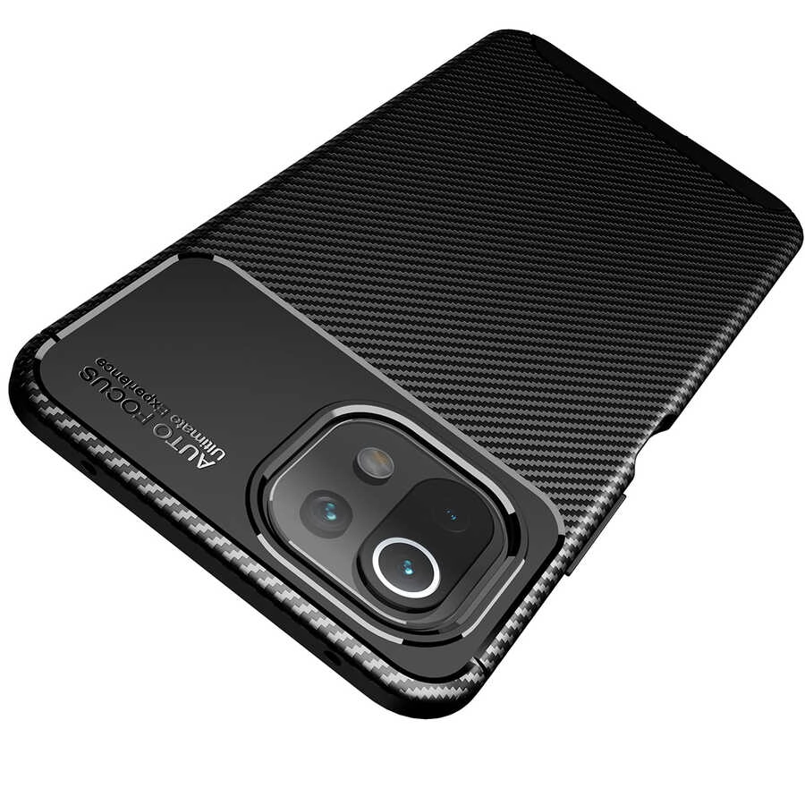 Xiaomi Uyumlu  Mi 11 Lite Kılıf Zore Negro Silikon Kapak