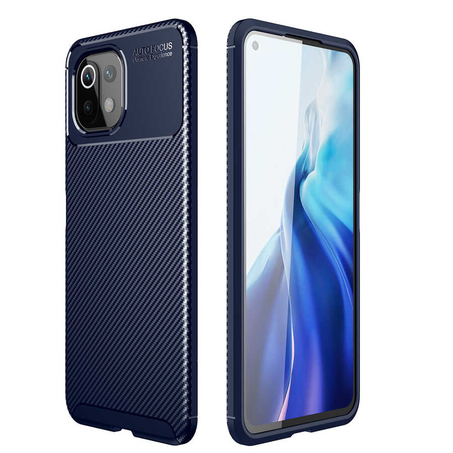 Xiaomi Uyumlu  Mi 11 Lite Kılıf Zore Negro Silikon Kapak-Lacivert