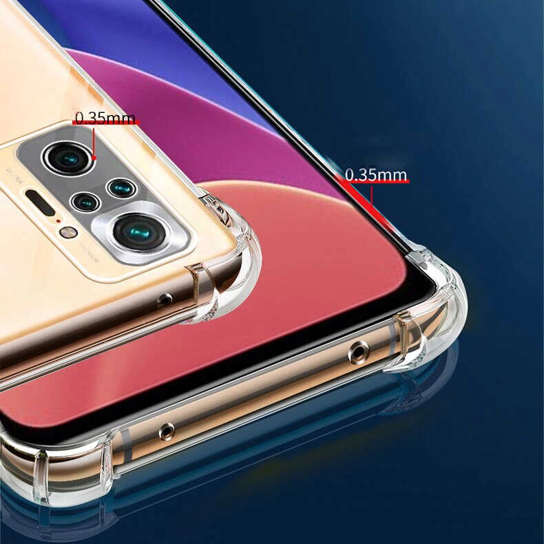 Xiaomi Uyumlu  Redmi Note 10S Kılıf Zore Kamera Korumalı Nitro Anti Shock Silikon
