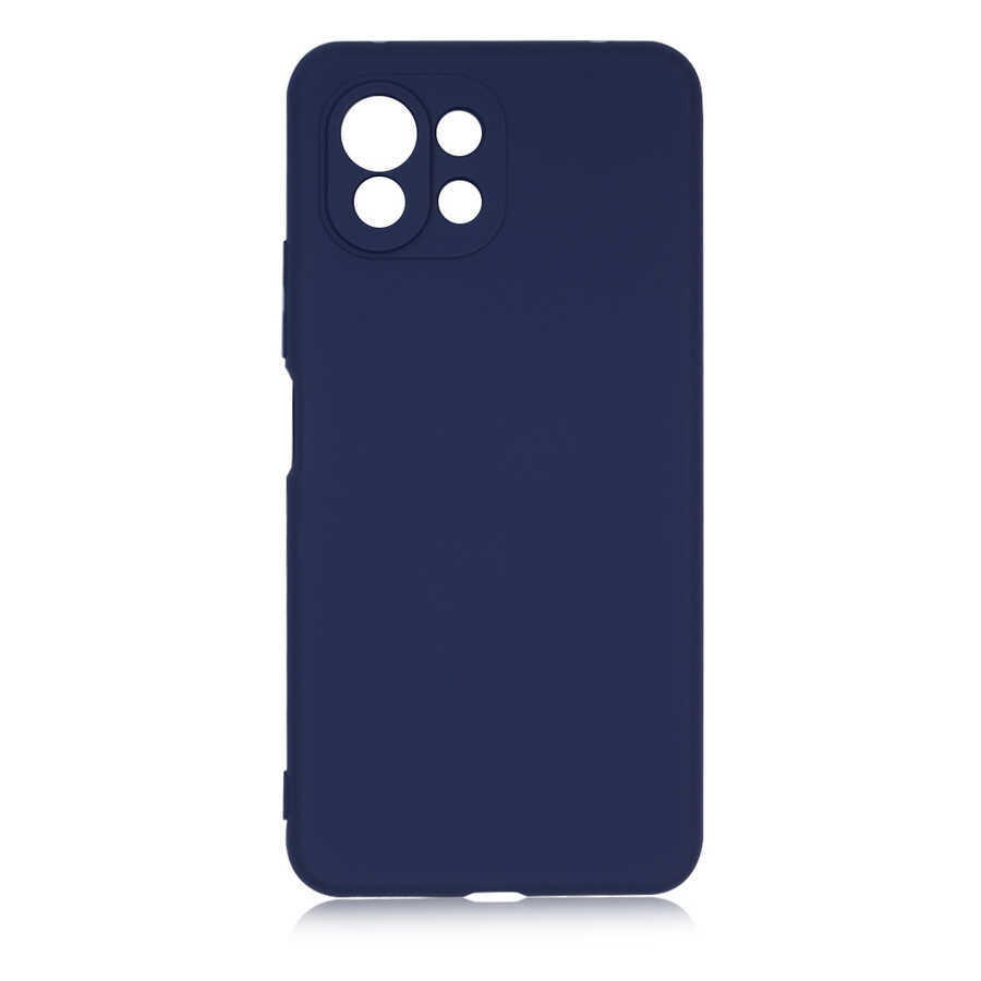Xiaomi Uyumlu  Mi 11 Lite Kılıf Zore Mara Lansman Kapak-Lacivert