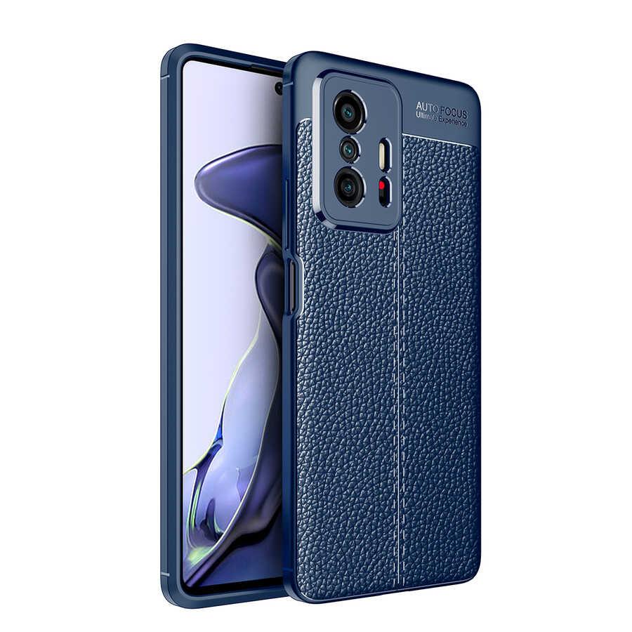 Xiaomi Uyumlu  Mi 11T 5G Kılıf Zore Niss Silikon Kapak