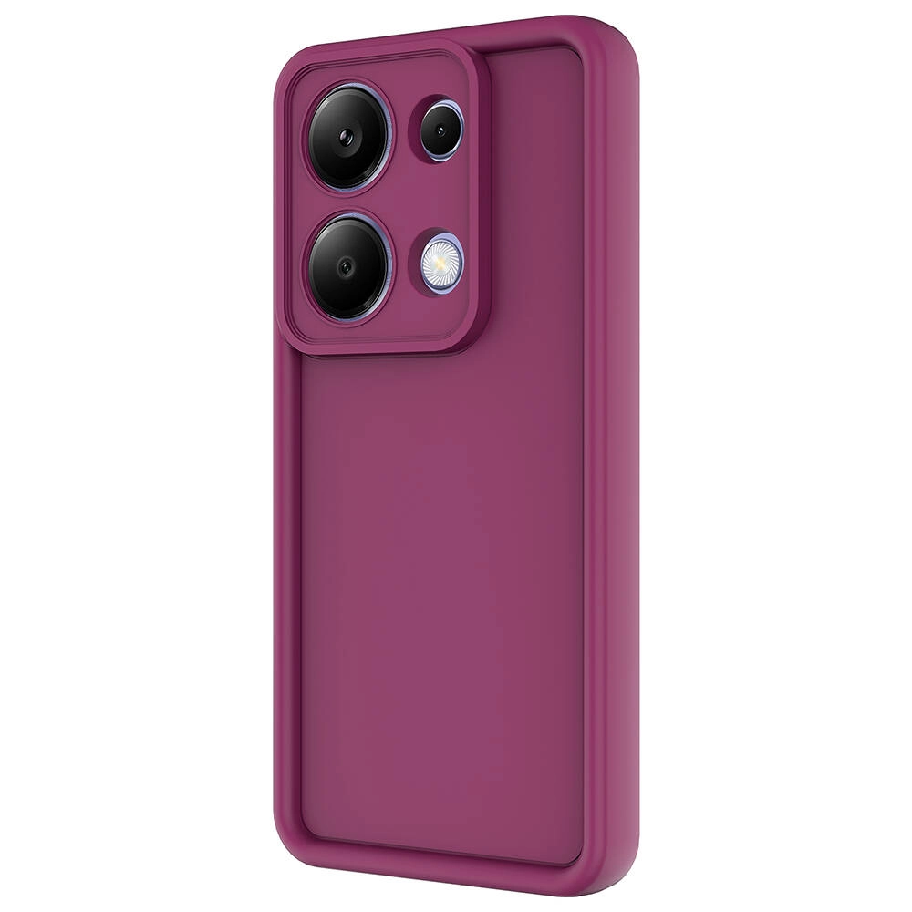 Xiaomi Uyumlu  Redmi Note 13 Pro 4G Kılıf Kamera Korumalı Zore Ananas Kapak