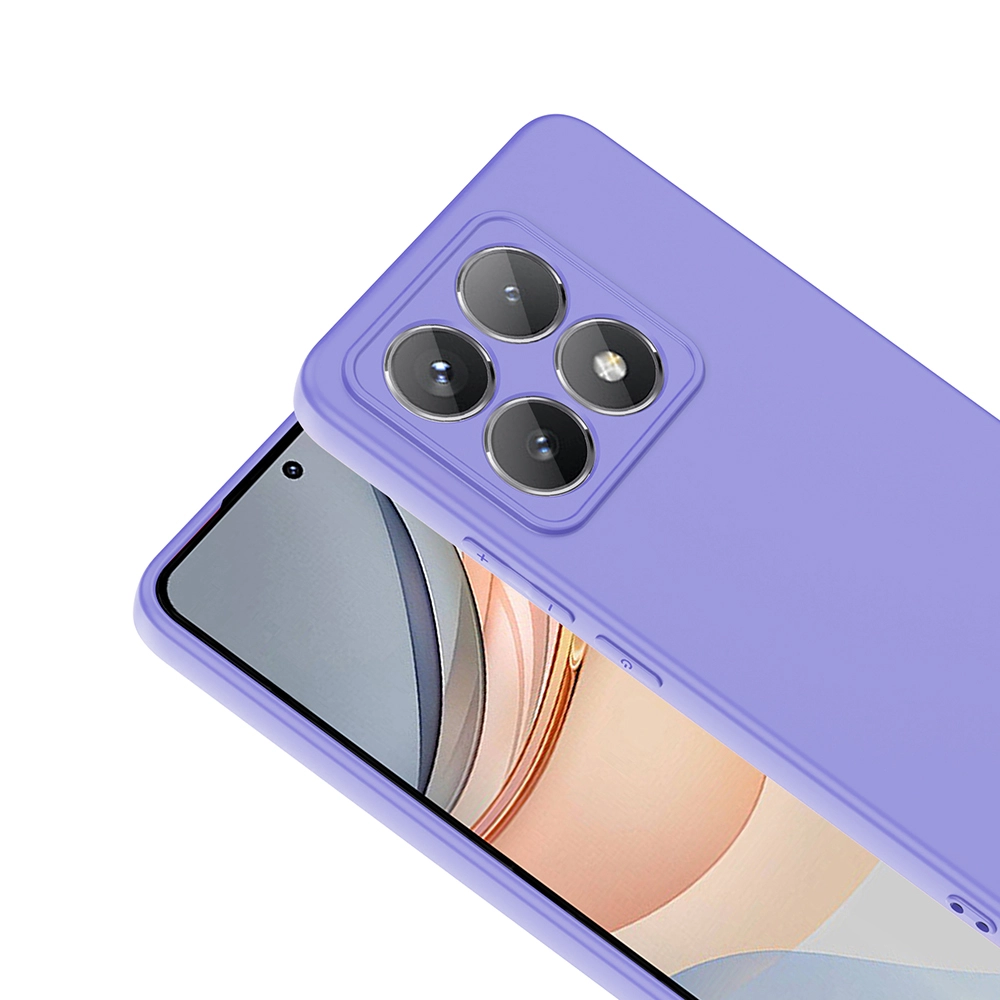 Xiaomi Uyumlu  14T Kılıf Zore Mara Lansman Kapak