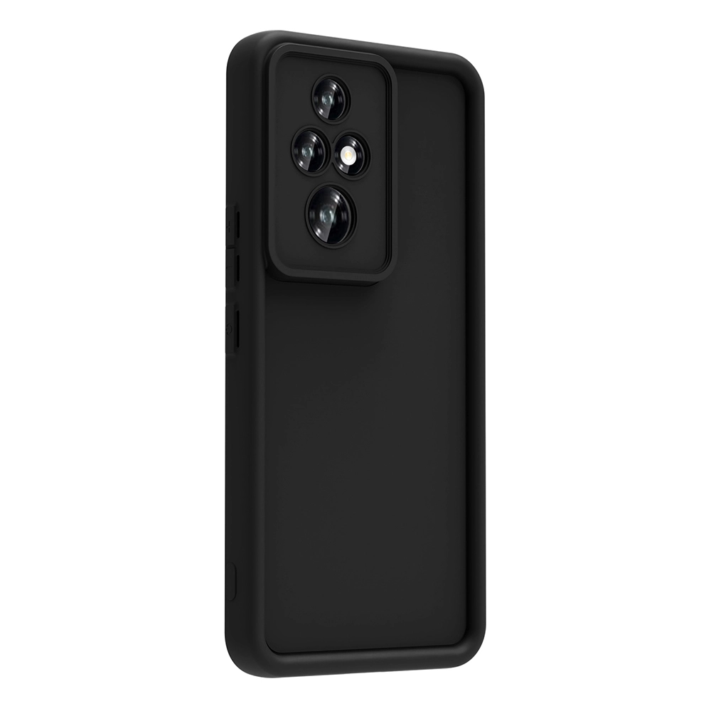 Honor 200 Pro Kılıf Kamera Korumalı Zore Ananas Kapak