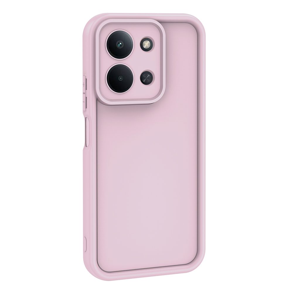 Xiaomi Uyumlu Redmi 15C Kılıf Kamera Korumalı Zore Ananas Kapak
