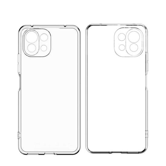Xiaomi Uyumlu  Mi 11 Kılıf Zore Kamera Korumalı Süper Silikon Kapak