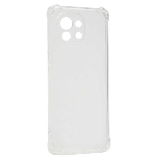 Xiaomi Uyumlu  Mi 11 Kılıf Zore Kamera Korumalı Nitro Anti Shock Silikon