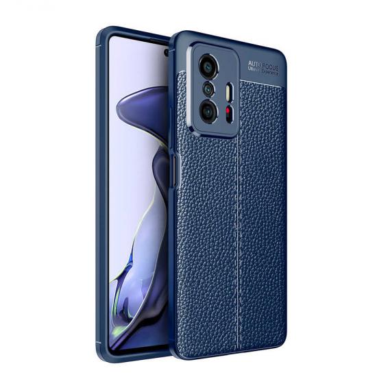 Xiaomi Uyumlu  Mi 11T 5G Kılıf Zore Niss Silikon Kapak
