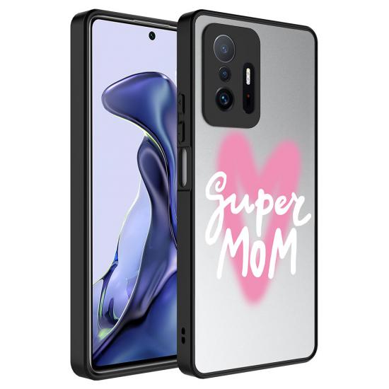 Xiaomi Uyumlu  Mi 11T 5G Kılıf Aynalı Desenli Kamera Korumalı Parlak Zore Mirror Kapak