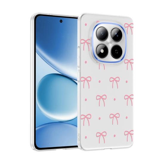Xiaomi Uyumlu Redmi Note 15 Pro Plus Kılıf Kamera Korumalı Desenli Zore Klip Kapak
