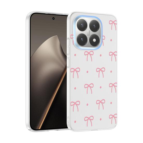 Xiaomi Uyumlu 15T Kılıf Kamera Korumalı Desenli Zore Klip Kapak